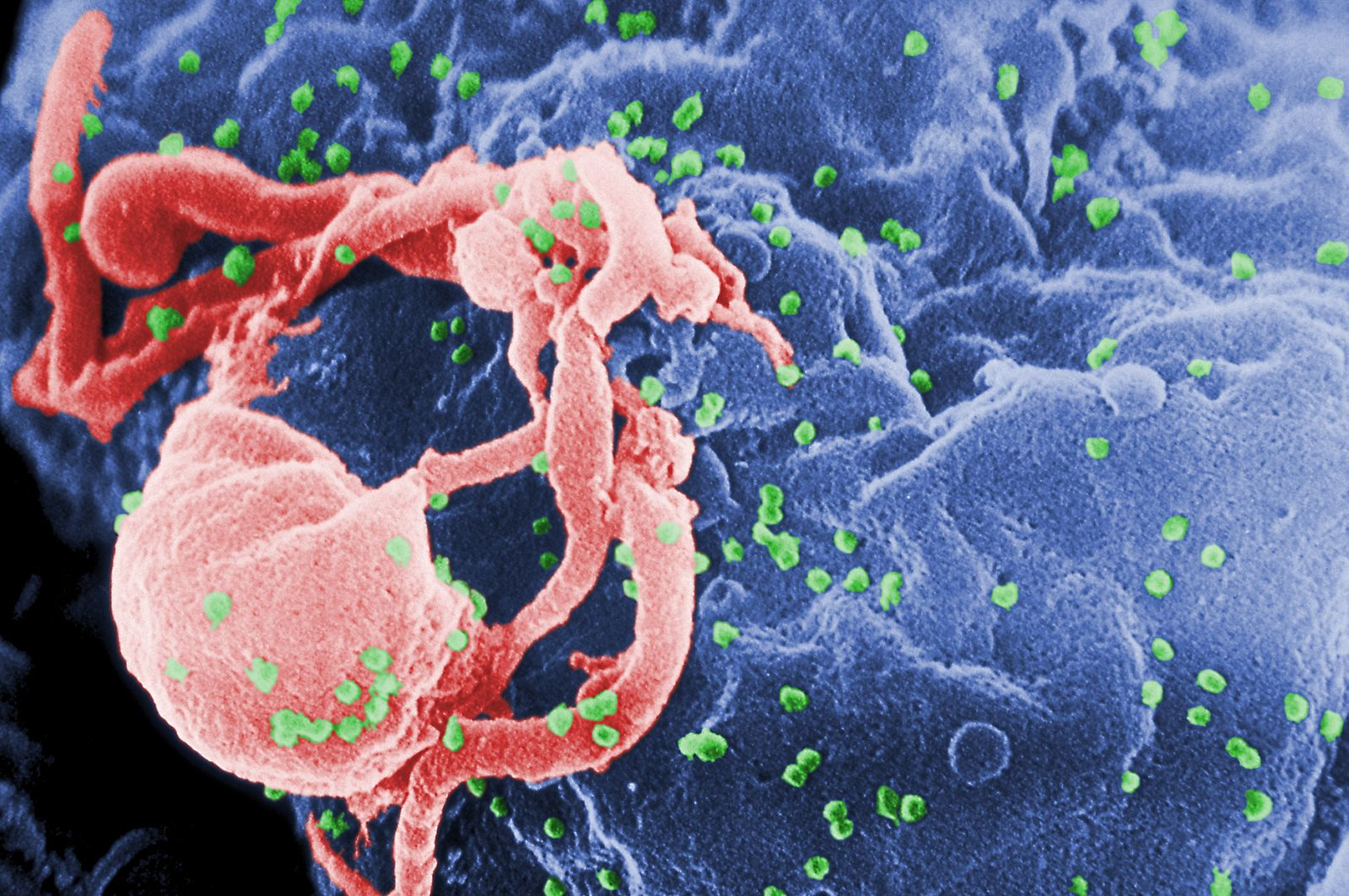 9 Myths About HIV and AIDS